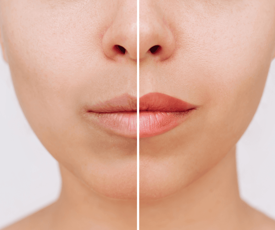 Even, balanced lips enhanced with soft neutralisation